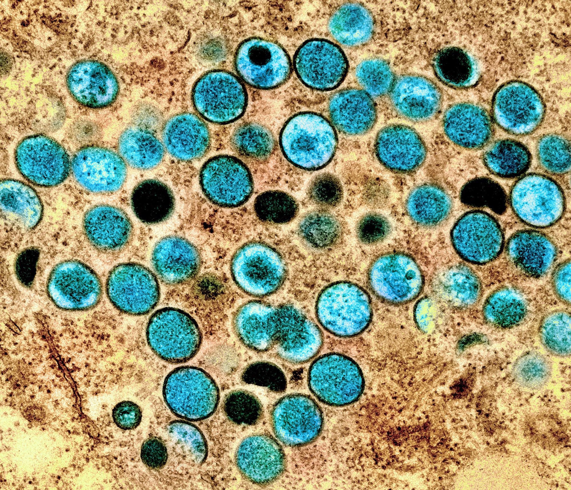 Study: Multiple lineages of Monkeypox virus detected in the United States, 2021- 2022. Image Credit: NIAID