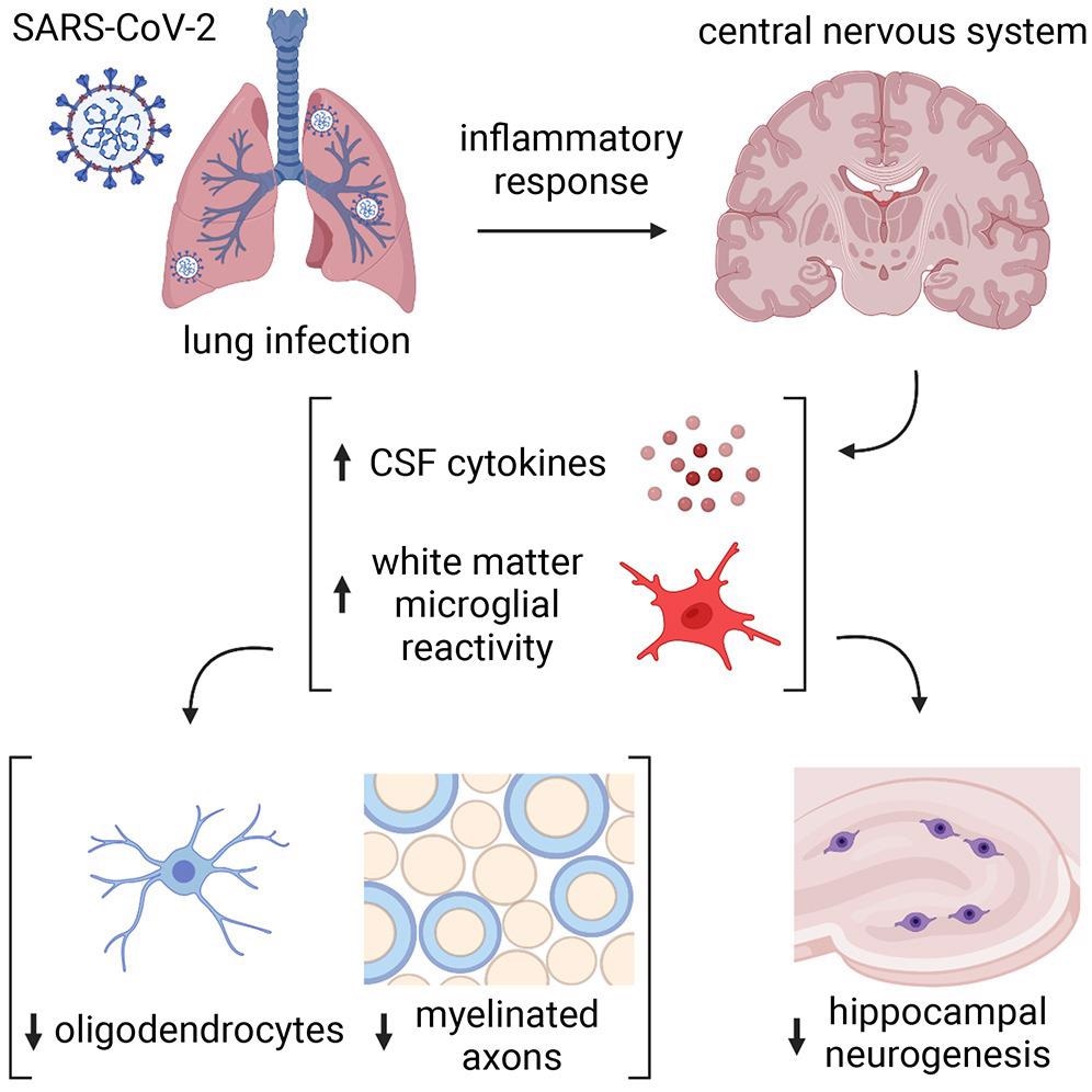 Study: Mild respiratory COVID can cause multi-lineage neural cell and myelin dysregulation