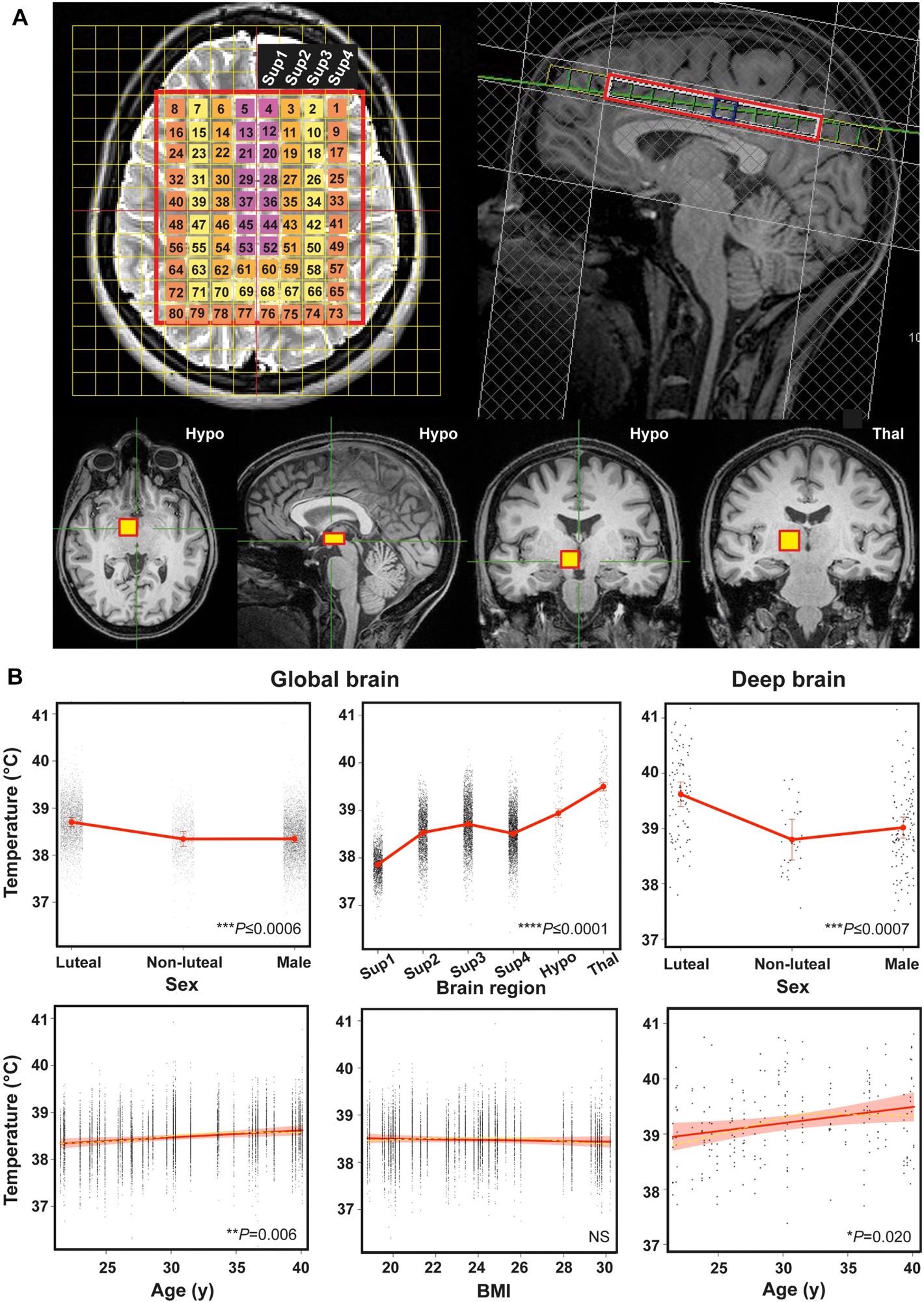 Human brain temperature is spatially heterogenous. (A) Representative annotated MR images to show MRS extraction protocol immediately after whole-brain structural acquisition. T2-weighted axial (top left) and T1-weighted mid-sagittal (top right) image showing multivoxel MRS overlay for more superficial brain regions including cerebral grey and white matter; note positioning superior to corpus callosum. From this multivoxel acquisition, MRS data was extracted from each of the numbered voxels individually; for the final statistical model, the whole cerebral region was split into four superficial groups of voxels (Sup 1–4, depicted as separate colours in the overlay, from medial to lateral). T1-weighted axial, sagittal and coronal images (bottom three images from left side, respectively) showing orthogonal positioning of single voxel in right hypothalamus (yellow box). T1-weighted coronal image (bottom right) showing positioning of single MRS voxel in right thalamus (yellow box).  (B) Linear mixed modelling results for global TBr by sex, age, brain region and BMI, and for deep TBr (including thalamus and hypothalamus) by sex and age. Solid red lines represent model fits, shaded areas and double-ended error bars represent 95% CIs, dark grey circles display residuals (single temperature data-points) and smoothed dashed yellow lines represent partial residuals. For sex, P-value reflects comparisons of each group with luteal females. For brain region, P-value represents comparisons of each region relative to superficial region 1 (parasagittal group of voxels). Sup 1–4 = superficial brain regions 1–4 from medial to lateral; Hypo = hypothalamus; Thal = thalamus.