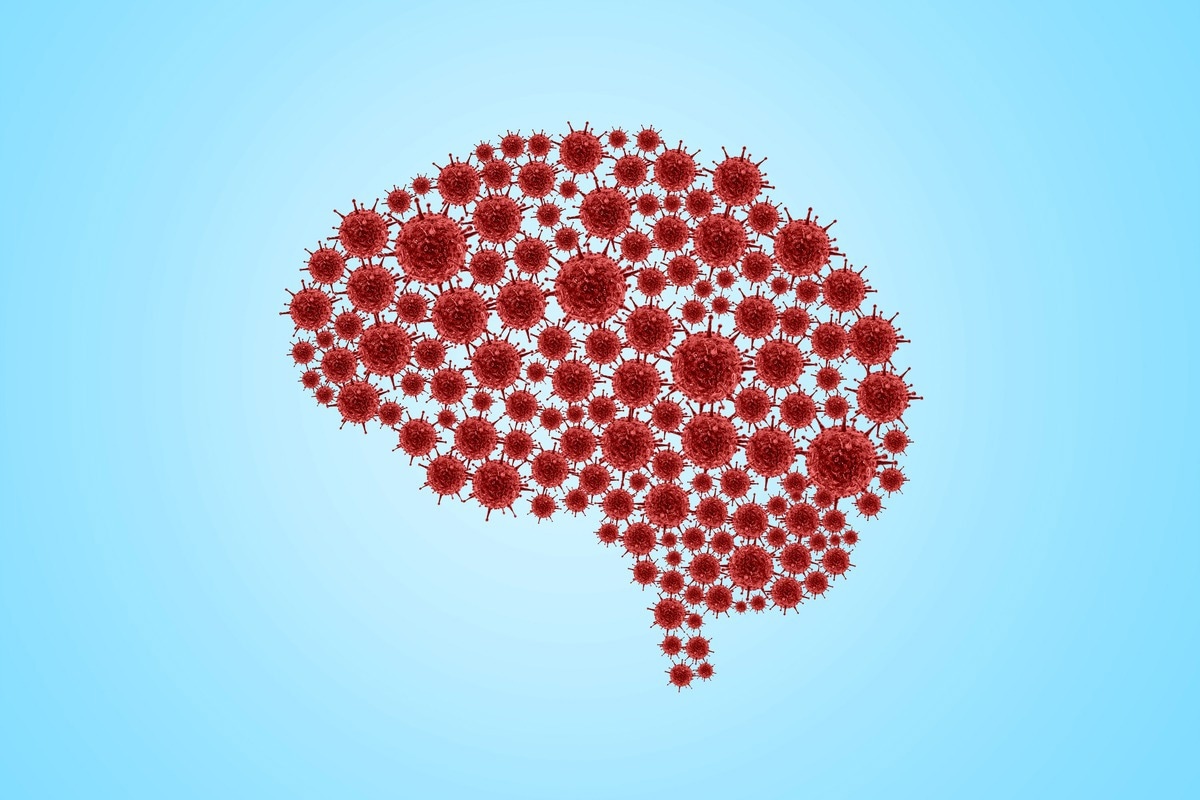 Study: What SARS-CoV-2 does to our brains. Image Credit: DOERS/Shutterstock