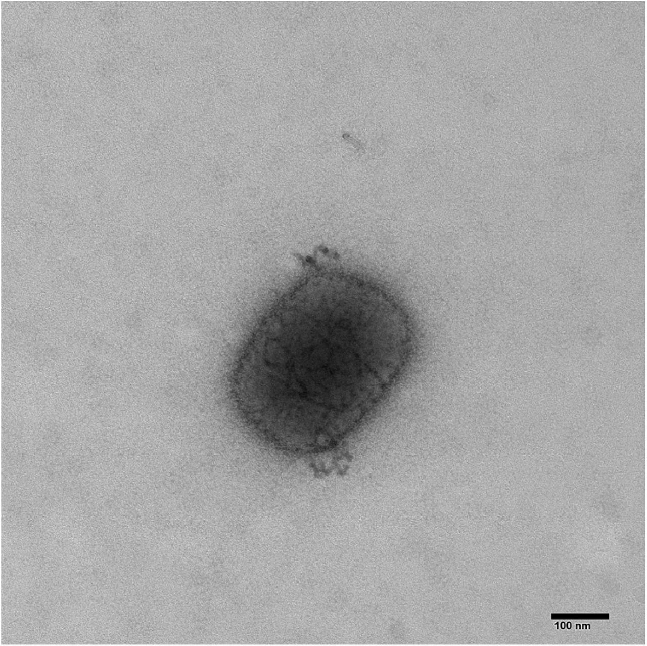 Transmission electron micrograph of Mulberry form pox virion cultured from a towel sampled in the patient’s bedroom. Direction magnificent = x92000.