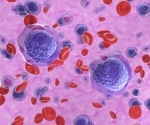 Rare Cells Capable of Transforming into Leukemia may Provide new Insight into Leukemic Landscape