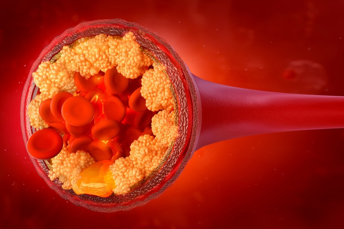 Etude : Cholestérol LDL : jusqu'où peut-on aller ?  Crédit d'image : Corona Borealis Studio/Shutterstock