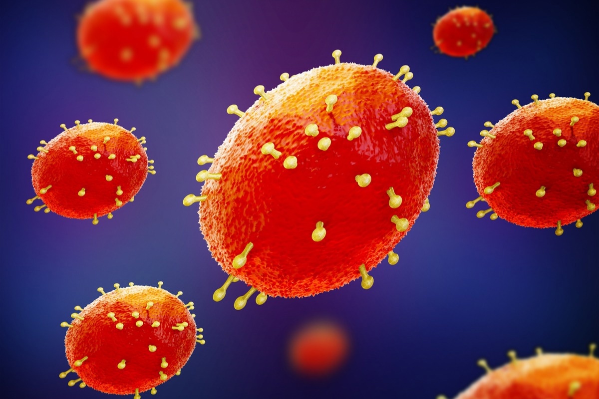 Study: Asymptomatic monkeypox virus infections among male sexual health clinic attendees in Belgium. Image Credit: MIA Studio/Shutterstock