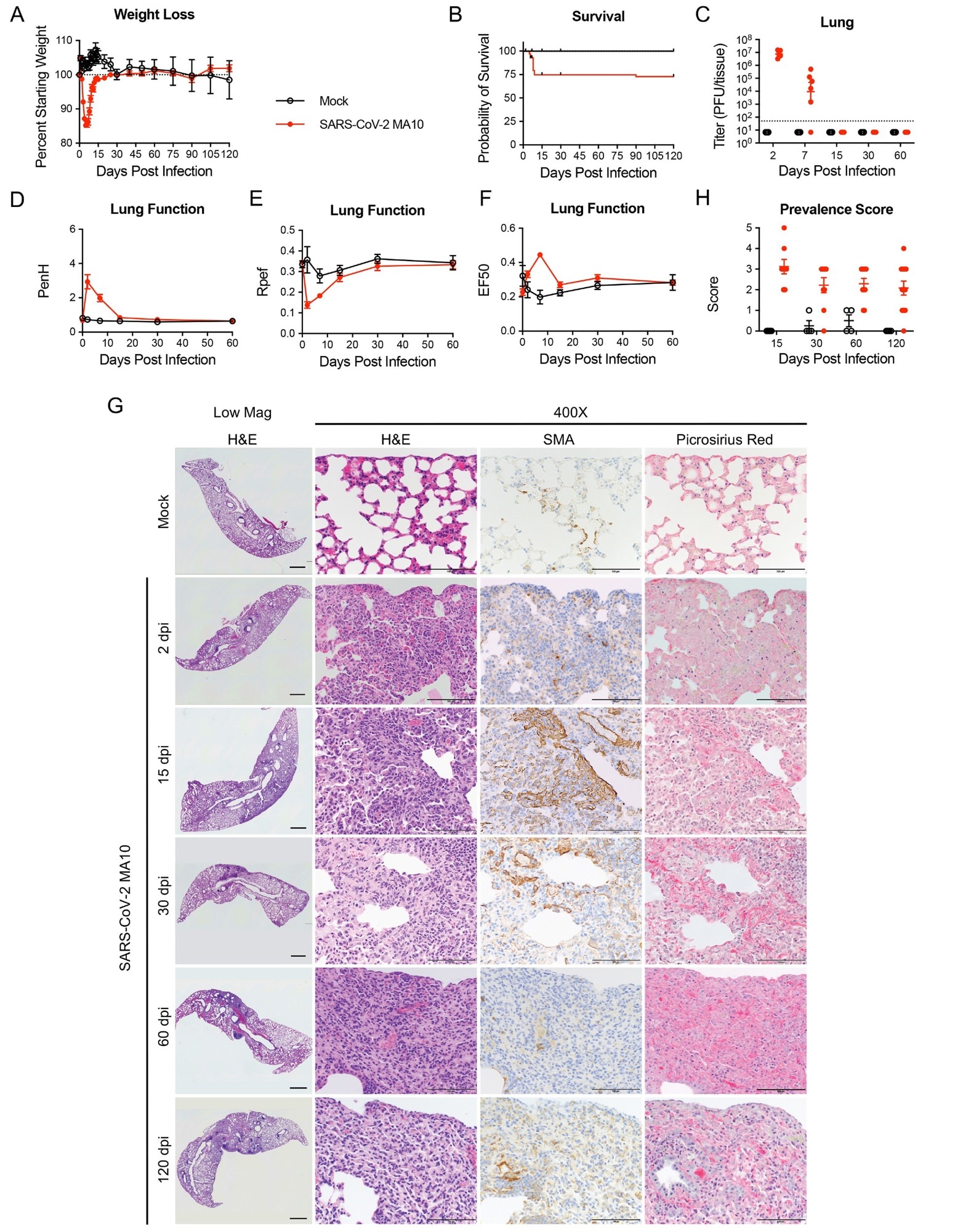 SARS-CoV-2 MA10 infection causes lung damage in aged surviving mice. 1-year-old female BALB/c mice were infected with 103 PFU SARS-CoV-2 MA10 (n=74) or PBS (n=24) and monitored for (A) percent starting weight and (B) survival. (C) Log transformed infectious virus lung titers were assayed at indicated time points. Dotted line represents LOD. Undetected samples are plotted at half the LOD. (D to F) Lung function was assessed by whole-body plethysmography for (D) PenH, (E) Rpef, and (F) EF50. (G) Histopathological analysis of lungs at indicated time points are shown. H&E indicates hematoxylin and eosin staining. SMA indicates DAB-labeling (brown) immunohistochemistry for α-smooth muscle actin. Picrosirius Red staining (bright pink-red) highlights collagen fibers. Image scale bars represents 1000 μm for low magnification and 100 μm for 400X images. (H) Disease incidence scoring is shown for indicated time points: 0 = 0% of total area of examined section, 1 = less than 5%; 2 = 6 to 10%; 3 = 11 to 50%; 4 = 51 to 95%; 5 = greater than 95%. Graphs represent individuals necropsied at each time point (C and H), with the average value for each treatment and error bars representing standard error of the mean. Mock infected animals represented by open black circles and SARS-CoV-2 MA10 infected animals are represented by closed red circles.