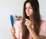 Does COVID-19 cause hair loss?