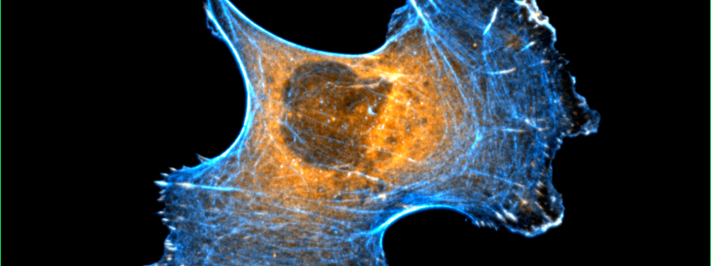 Study offers insight into cancer cell migration and opens new possibilities for stopping it