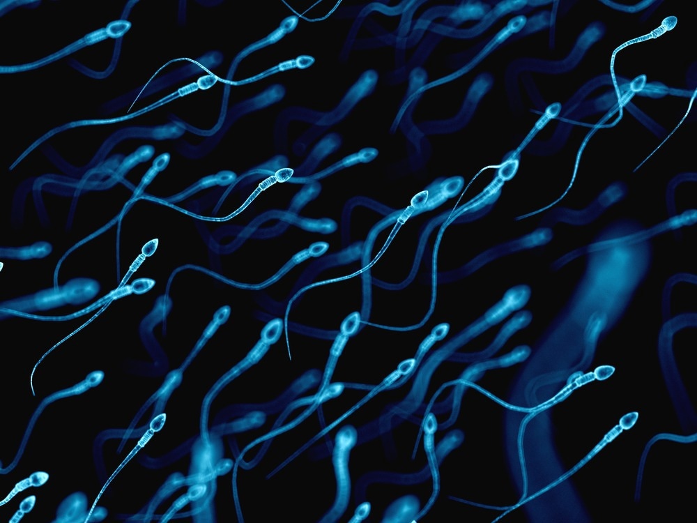 Study: Impact of Escherichia coli Outer Membrane Vesicles on Sperm Function. Image Credit: SciePro / Shutterstock.com