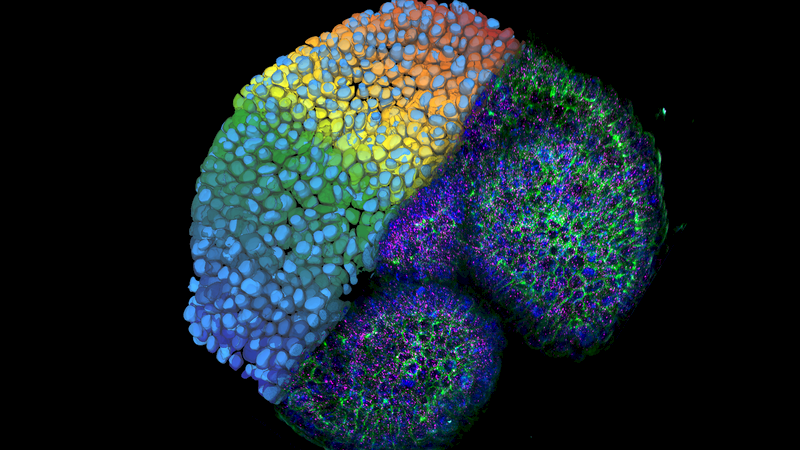 Intestine organoid with nuclei (DAPI, blue), plasma membrane (green), and smFISH probe (magenta) labeling imaged with a THUNDER 3D tissue imager system and analyzed with Aivia’s new integrated Cellpose and 3D Cell Analysis recipe. Image Credit: Leica Microsystems Inc.