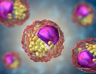 Nanoparticles' toxic effects on macrophages