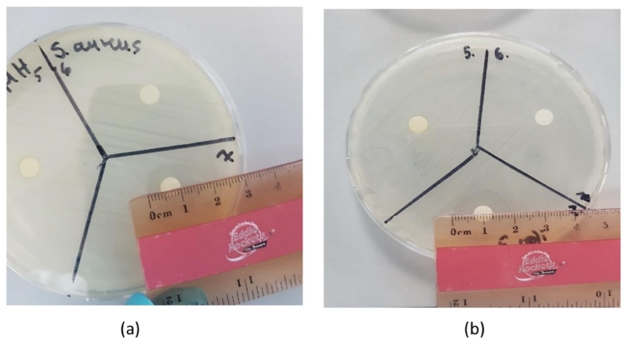 The measurement of the inhibition zone of tea tree oil on different bacteria: (a) S. aureus and (b) E. coli.