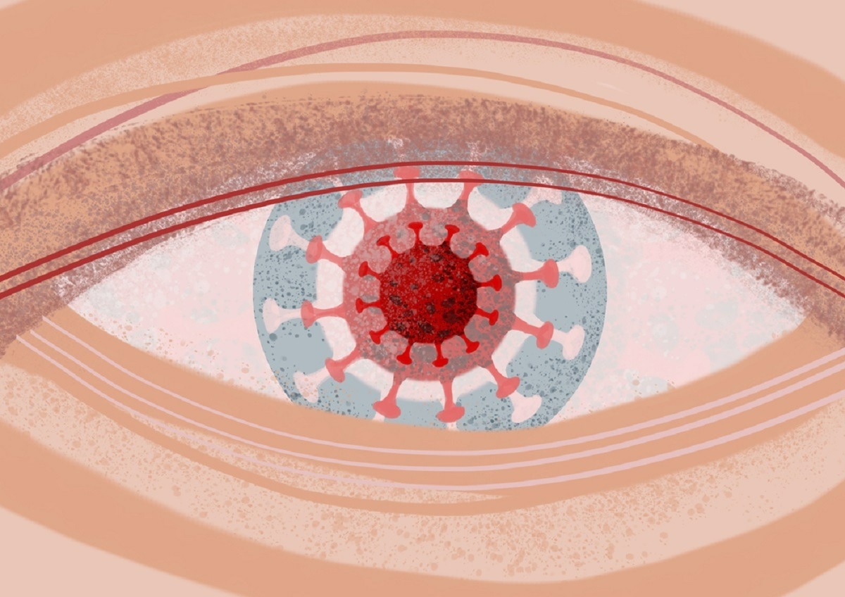 Study: In vitro infection of human ocular tissues by SARS-CoV-2 lineage A isolates. Image Credit: A Odo/Shutterstock