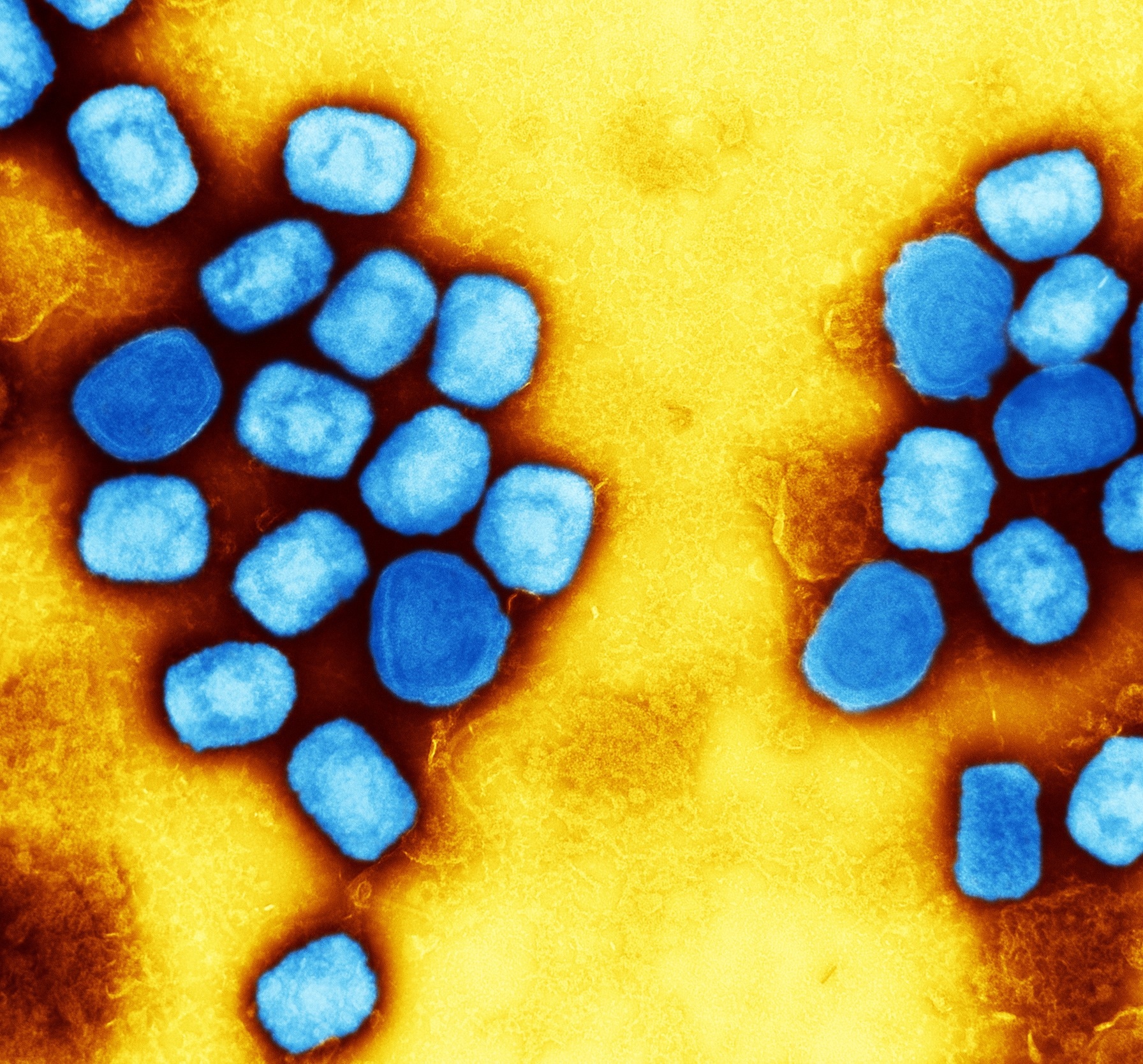 میکروگراف الکترونی عبوری رنگی ذرات ویروس آبله میمون (آبی) کشت و خالص شده از کشت سلولی.  تصویر گرفته شده در مرکز تحقیقات یکپارچه NIAID (IRF) در فورت دیتریک، مریلند.  اعتبار: NIAID