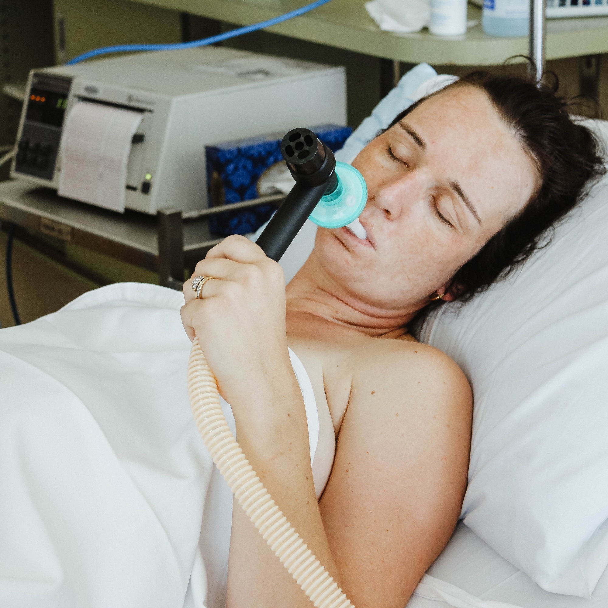 Study determines the impact of withholding nitrous oxide for labor analgesia