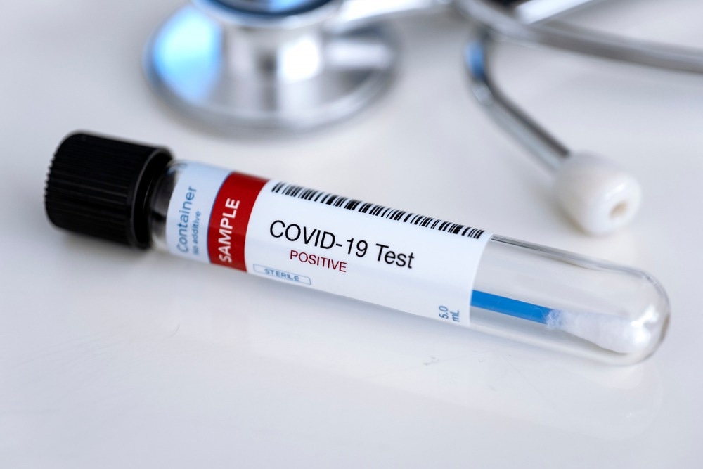 Study: Awareness of SARS-CoV-2 Omicron Variant Infection Among Adults With Recent COVID-19 Seropositivity. Image Credit: Myriam B / Shutterstock.com
