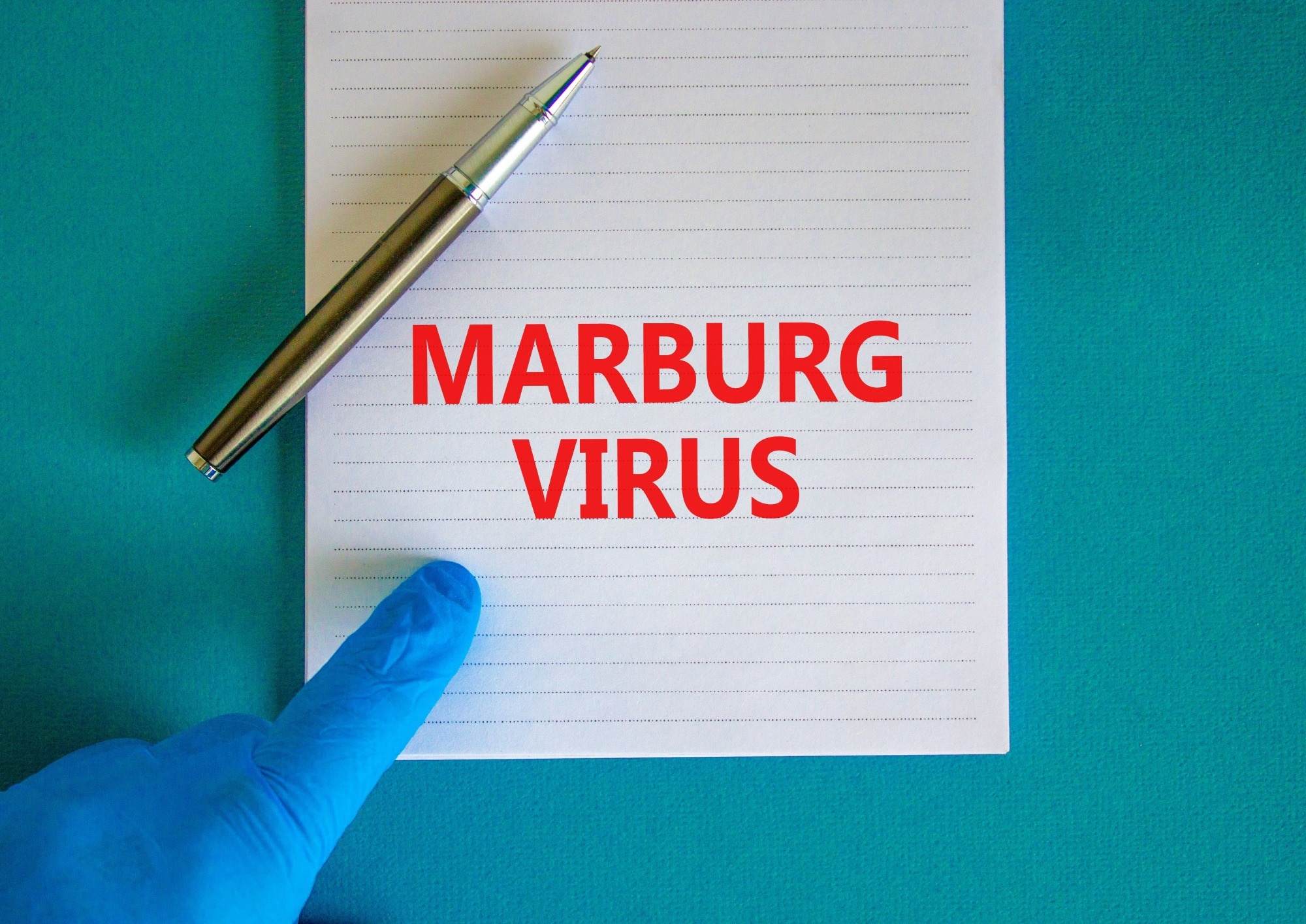 Study: Marburg virus outbreak in Ghana: An impending crisis. Image Credit: Dmitry Demidovich/Shutterstock