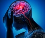 Designing a new treatment to treat migraine effectively