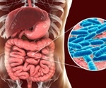Is there an association between the gut microbiome of people within different countries and the severity of COVID-19?