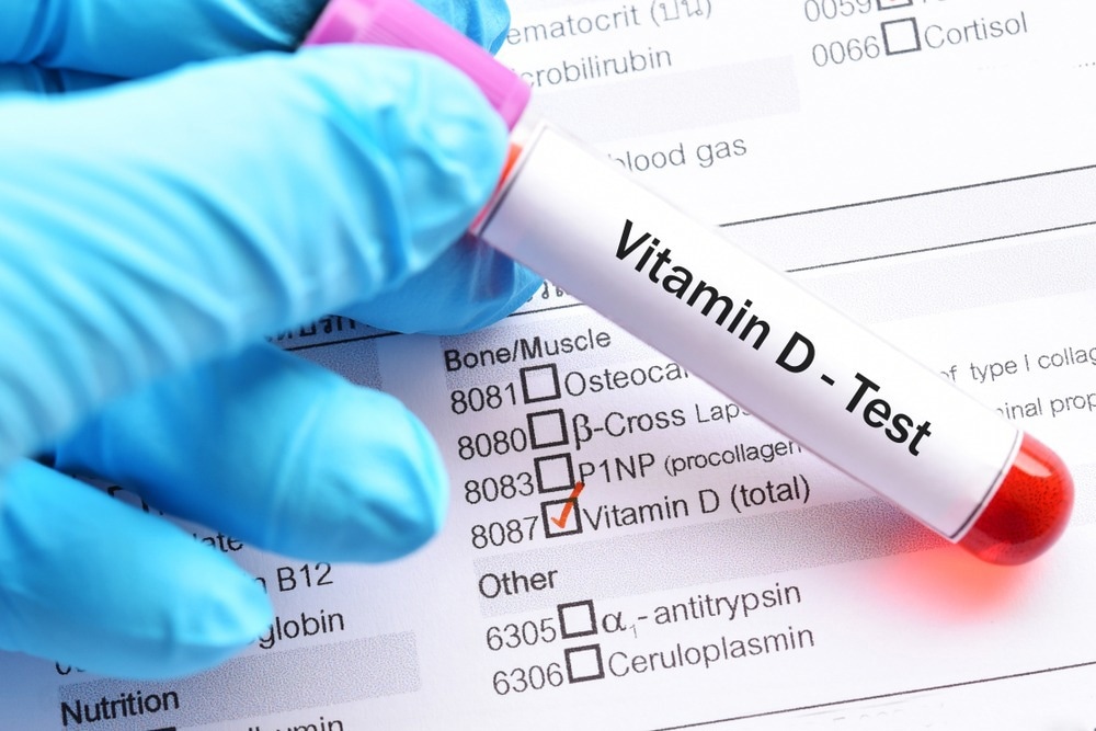 Vitamin D mediates crosstalk between COVID-19 and osteoporosis
