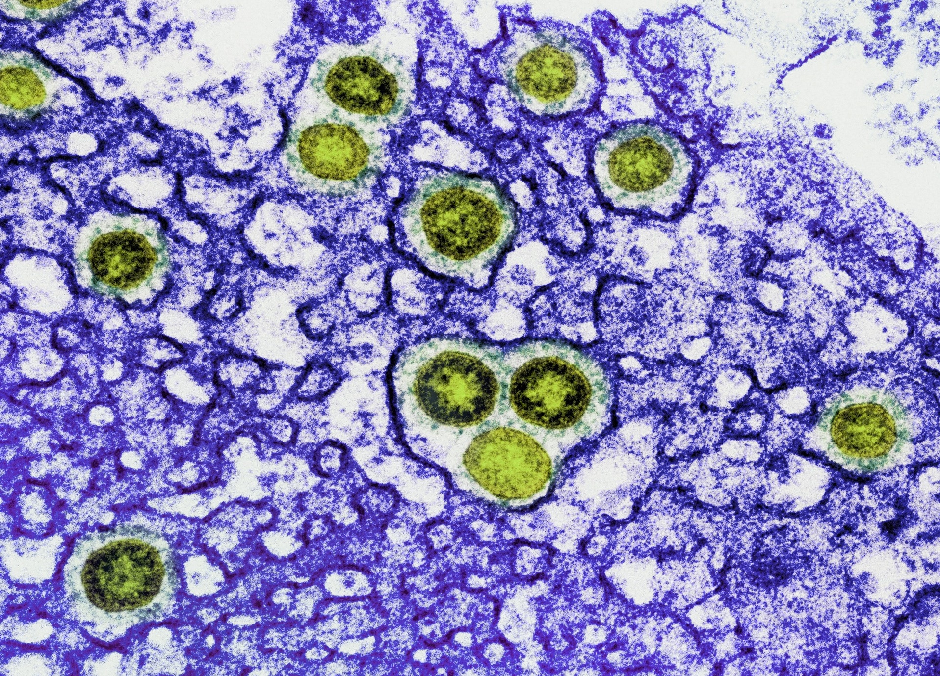 NIH animal study combines Paxlovid with Lagevrio against SARS-CoV-2 Delta – News-Medical.Net