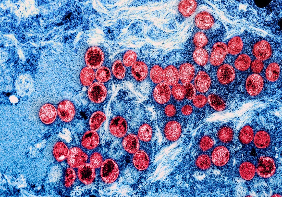 Study: Genome Characterization of Monkeypox Cases Detected in India: Identification of Three Subclusters Within the A.2 Lineage.  Photo credit: NIAID