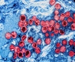 Evidence A.2 lineage of monkeypox is mutating