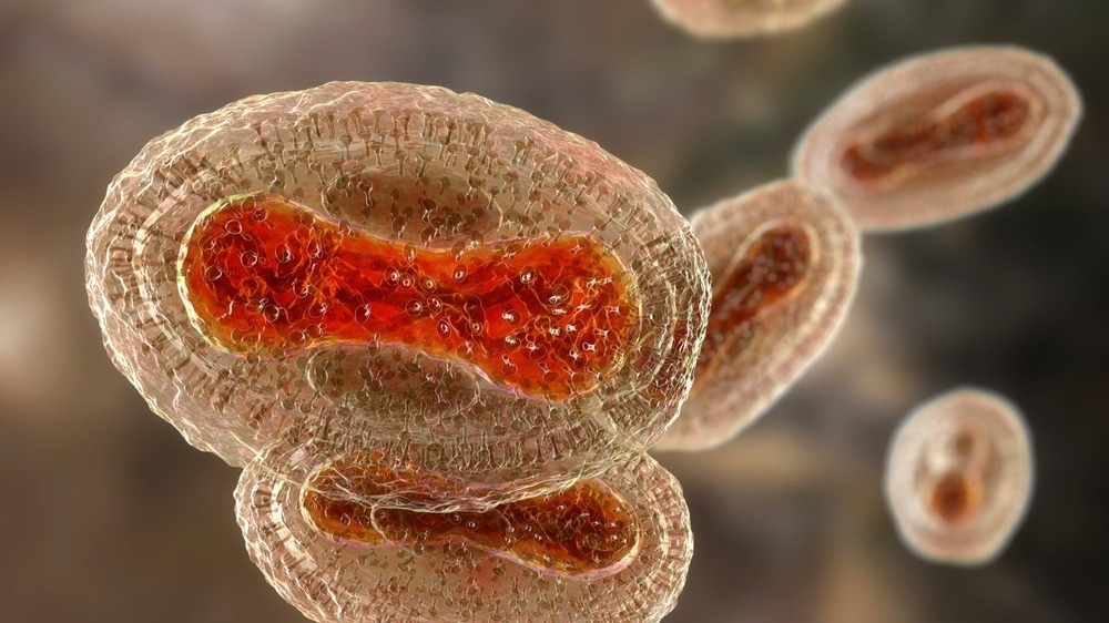 Étude : Complications neurologiques de la variole et du monkeypox.  Crédit d'image : Kateryna Kon/Shutterstock.com