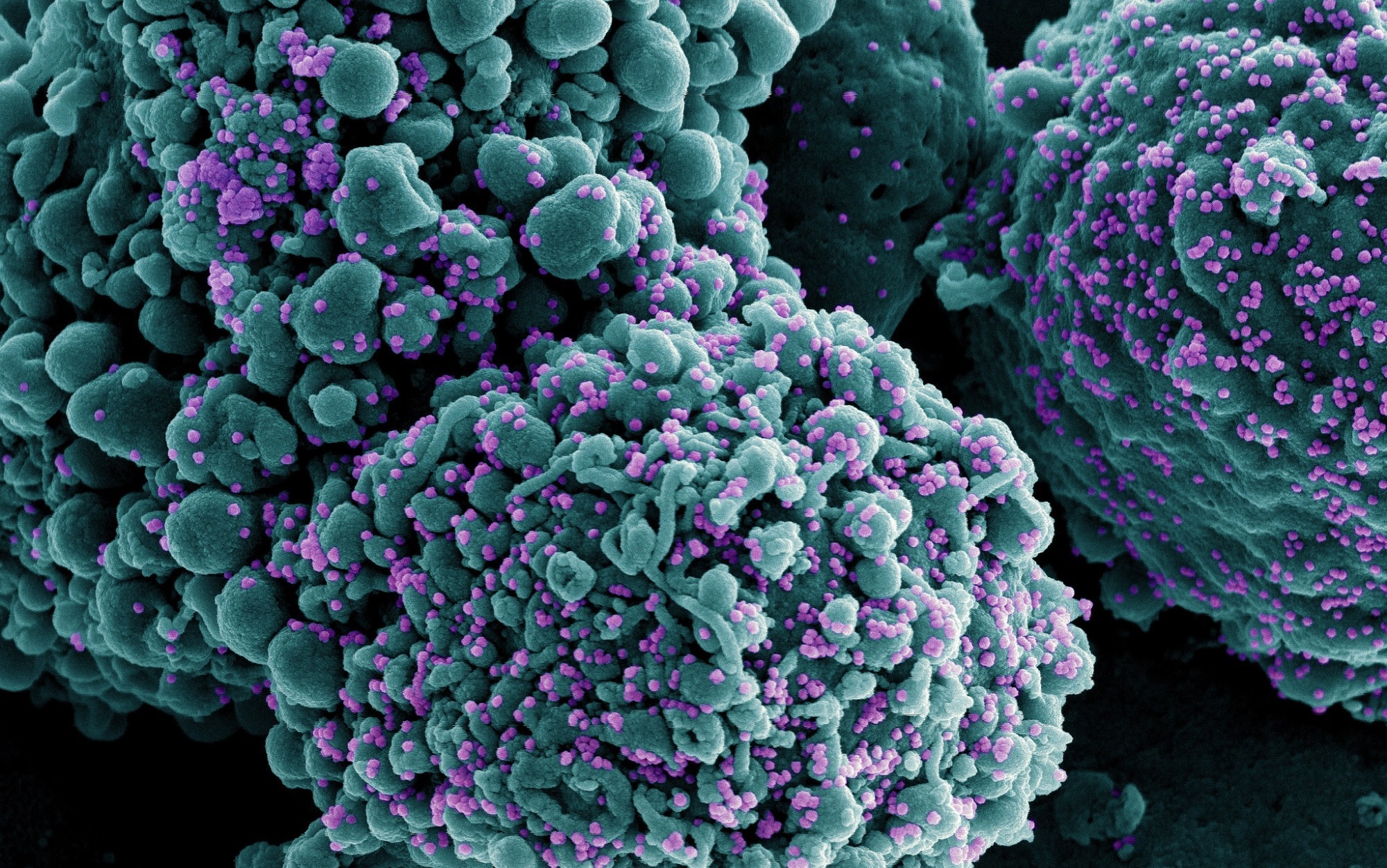 مطالعه: تقویت SARS-CoV-2 Omicron باعث ایجاد پاسخ جدید سلول B در انسان می شود.  اعتبار تصویر: NIAID