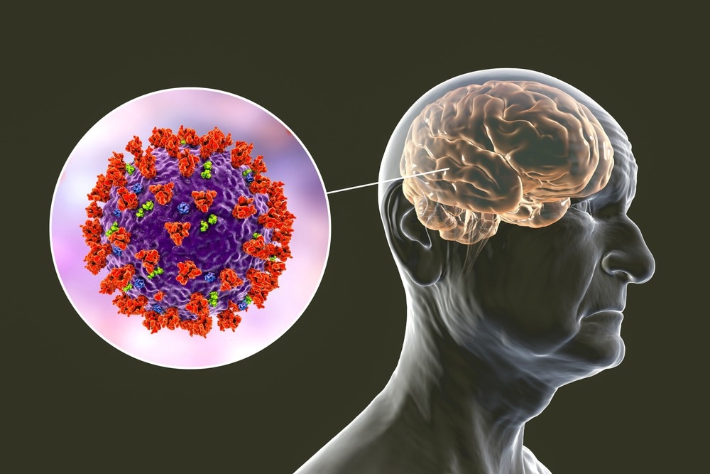 Study: Effects of SARS-CoV-2 Infection on Attention, Memory, and Sensorimotor Performance. Image Credit: Kateryna Kon/Shutterstock