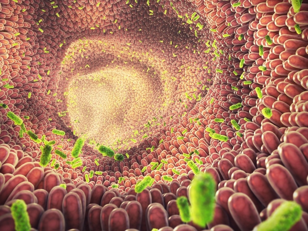 مطالعه: میکروبیوتای روده و کووید-19: پیامدهای بالقوه برای شدت بیماری.  اعتبار تصویر: nobeastsofierce / Shutterstock.com