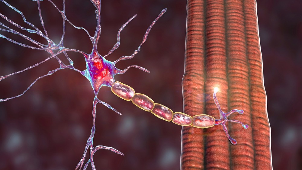Study: Prevention of ribosome collision-induced neuromuscular degeneration by SARS CoV-2–encoded Nsp1. Image Credit: Kateryna Kon/Shutterstock
