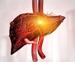 Chronic liver disease in COVID-19 patients