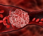 Amplification of venous thromboembolism risk by COVID-19 among malignancy patients