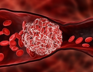 Amplification of venous thromboembolism risk by COVID-19 among malignancy patients