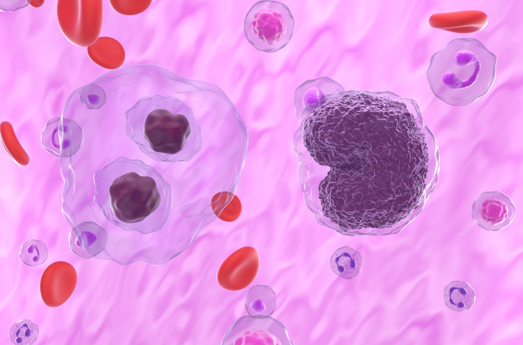 Study: Diagnosis and management of classical Hodgkin lymphomaduring the COVID-19 pandemic. Image Credit: Nemes Laszlo/Shutterstock
