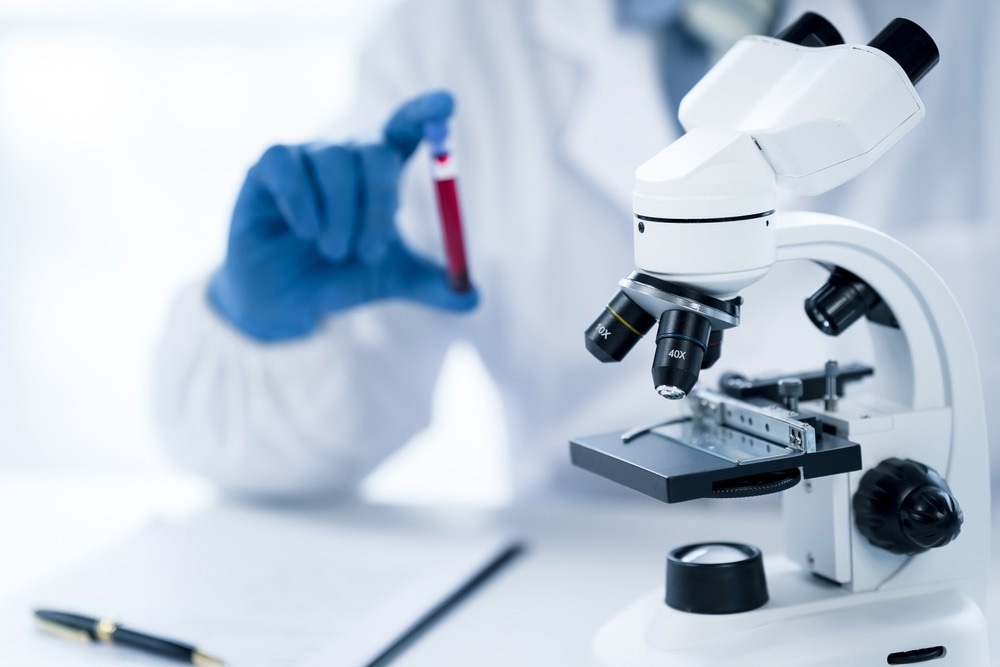 Study: Innovations in Infectious Disease Diagnostics. Image Credit: PaeGAG / Shutterstock.com