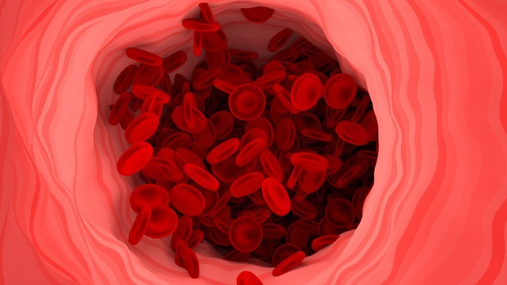 Study: Increased levels of inflammatory molecules in blood of Long COVID patients point to thrombotic endotheliitis. Image Credit: Dai Yim / Shutterstock.com