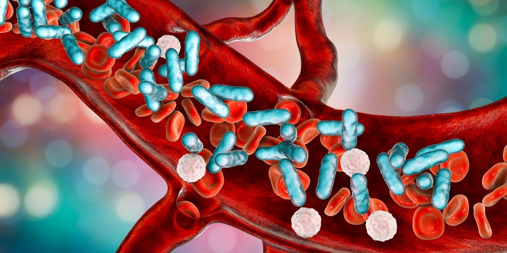 Study: Integrated host-microbe plasma metagenomics for sepsis diagnosis in a prospective cohort of critically ill adults. Image Credit: Kateryna Kon/Shutterstock