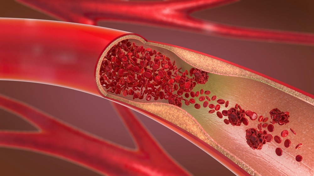 Study: Rapid Regeneration of a Neoartery with Elastic Lamellae. Image Credit: Christoph Burgstedt/Shutterstock