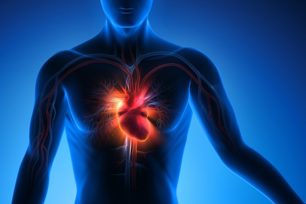 Étude : Contribution de la génétique et du mode de vie au risque de complications cardiovasculaires et thromboemboliques majeures suite au COVID-19.  Crédit d'image : peterschreiber.media/Shutterstock