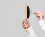 Can prostaglandin E2 injection improve hair growth?