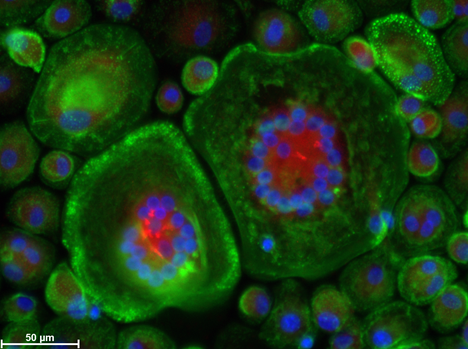 Human peripheral blood mononuclear cells (PBMCs) differentiated into osteoclasts. ALK (alkaline phosphatase) – red, F-actin (cytoskeleton) – green, cell nuclei – blue.