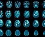 Pt(IV)-conjugated drug-delivery system shows efficacy in glioblastoma therapy