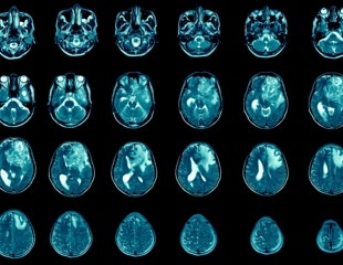 Pt(IV)-conjugated drug-delivery system shows efficacy in glioblastoma therapy