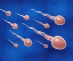 Does a vasectomy change the semen microbiome?