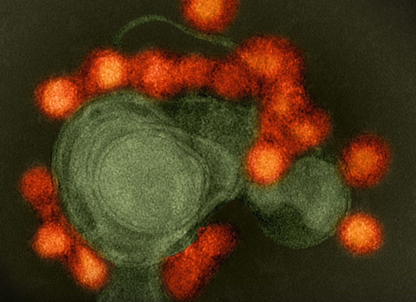 Study: A Zika virus-specific IgM elicited in pregnancy exhibits ultrapotent neutralization. Image Credit: NIAID