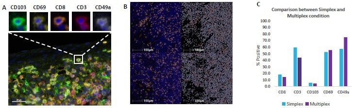 تجزیه و تحلیل سلول های T تنظیم کننده و موثر در تومورها