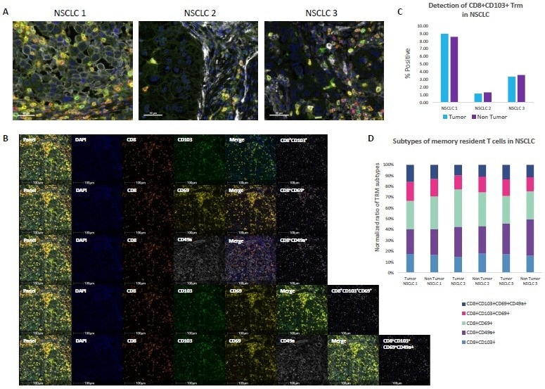 تجزیه و تحلیل سلول های T تنظیم کننده و موثر در تومورها