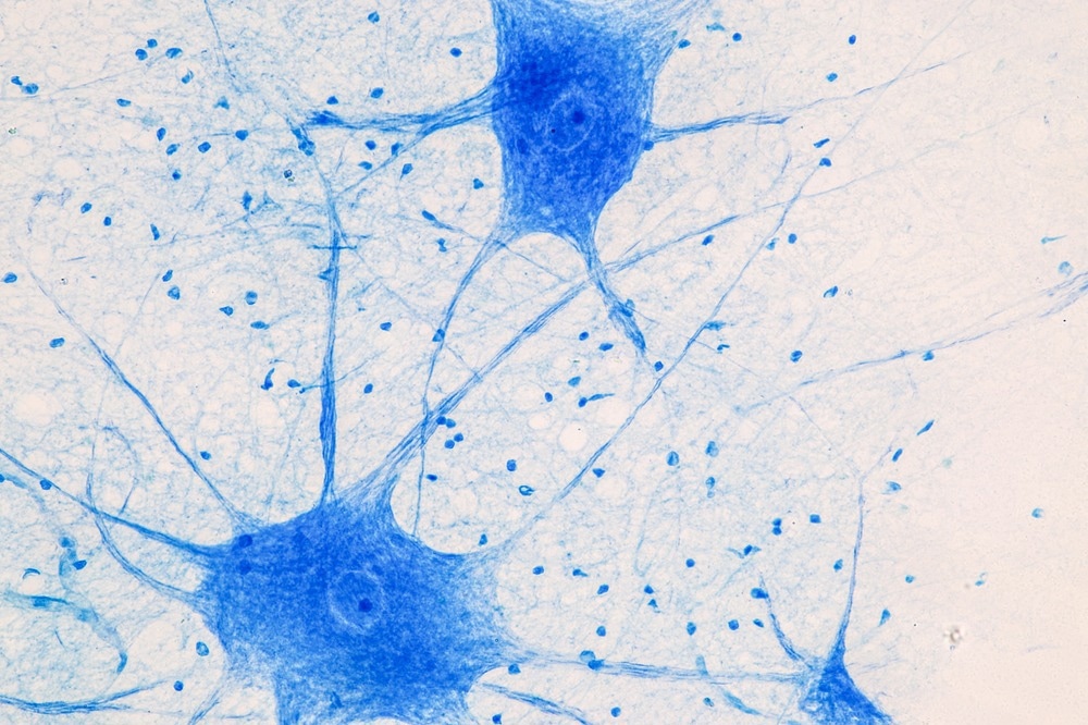 نورون های حرکتی زیر میکروسکوپ