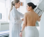 The potential for automatic diagnosis of palpable breast lumps without a radiologist or sonographer